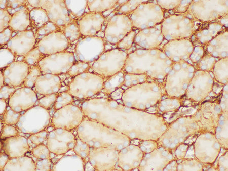 FGB Polyclonal Antibody Host Rabbit