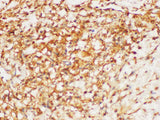 HRAS Polyclonal Antibody Reactivity Mouse