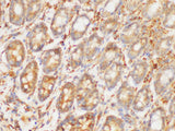 HRAS Polyclonal Antibody Reactivity Mouse