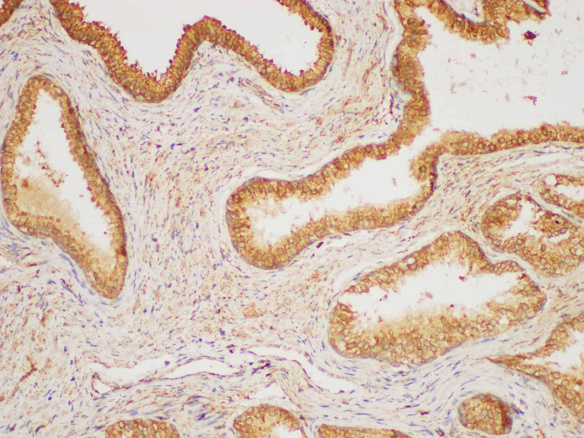 HRAS Polyclonal Antibody Reactivity Mouse