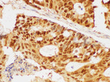 PCNA Polyclonal Antibody Host Rabbit