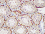 PCNA Polyclonal Antibody Host Rabbit