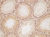 PCNA Polyclonal Antibody Host Rabbit