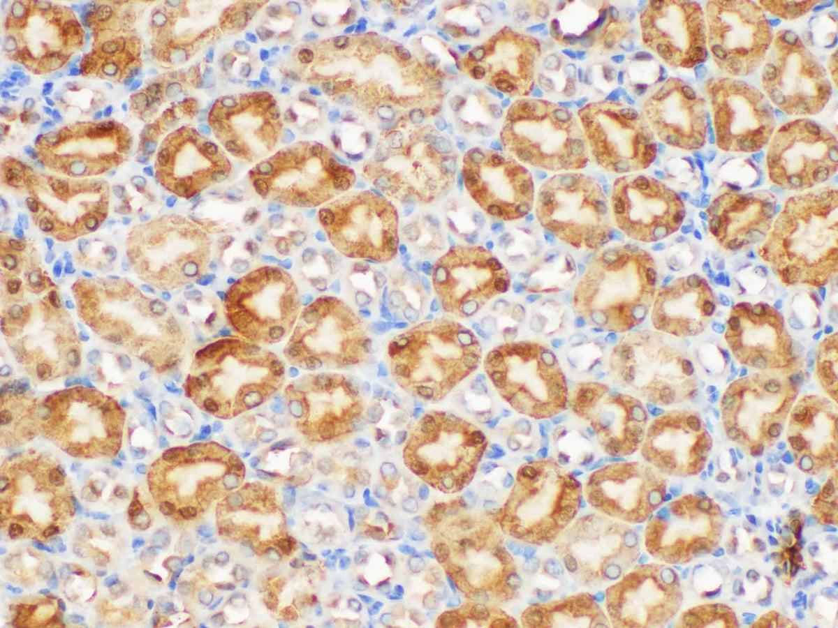 GSTp1 Polyclonal Antibody Host Rabbit