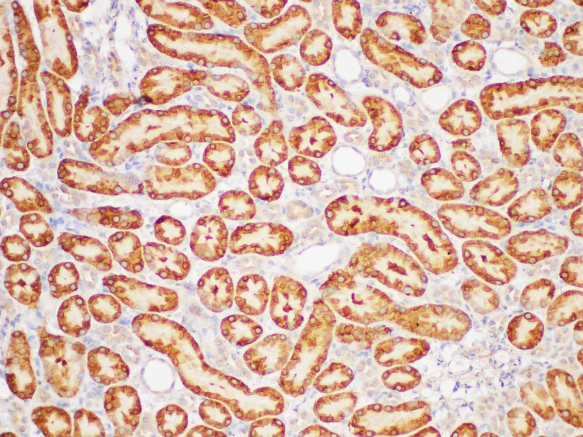 GSTp1 Polyclonal Antibody Host Rabbit