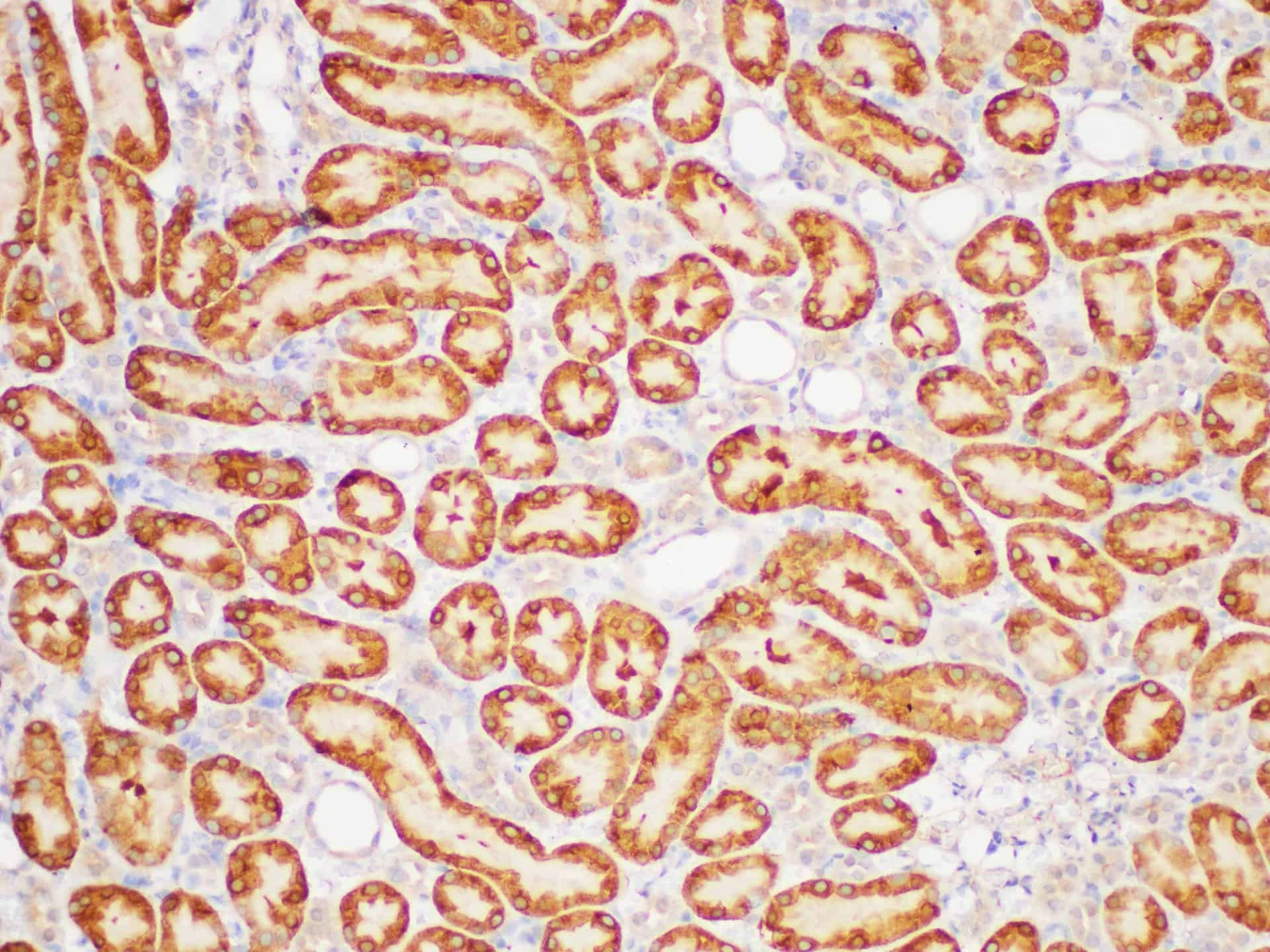 GSTp1 Polyclonal Antibody Host Rabbit