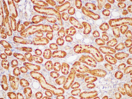 GSTp1 Polyclonal Antibody Host Rabbit