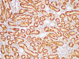 GSTp1 Polyclonal Antibody Host Rabbit