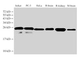GSTp1 Polyclonal Antibody Host Rabbit