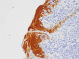 S100A7 Polyclonal Antibody Host Rabbit