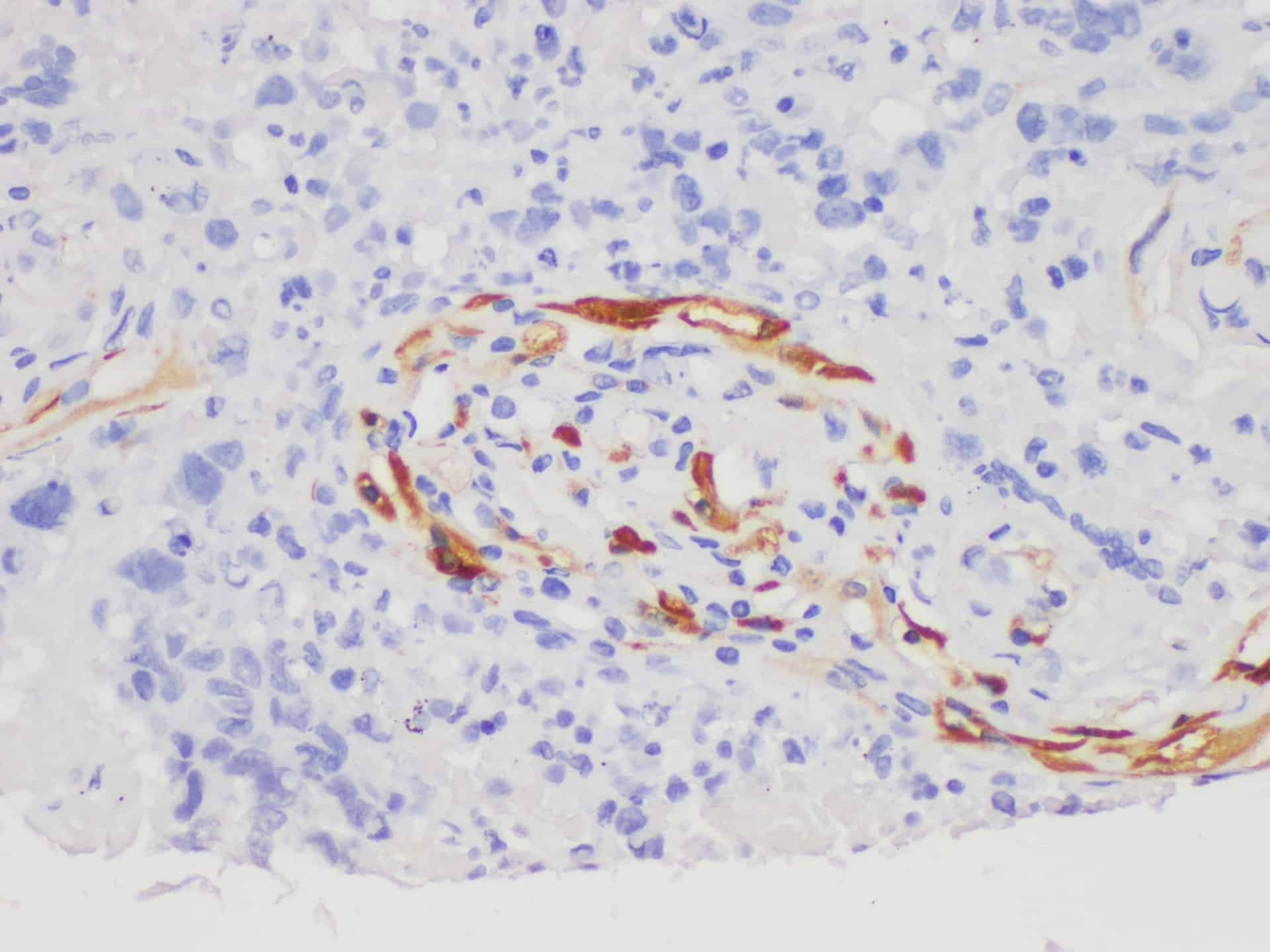 S100A7 Polyclonal Antibody Host Rabbit