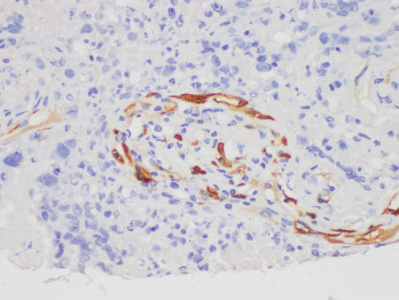 S100A7 Polyclonal Antibody Host Rabbit