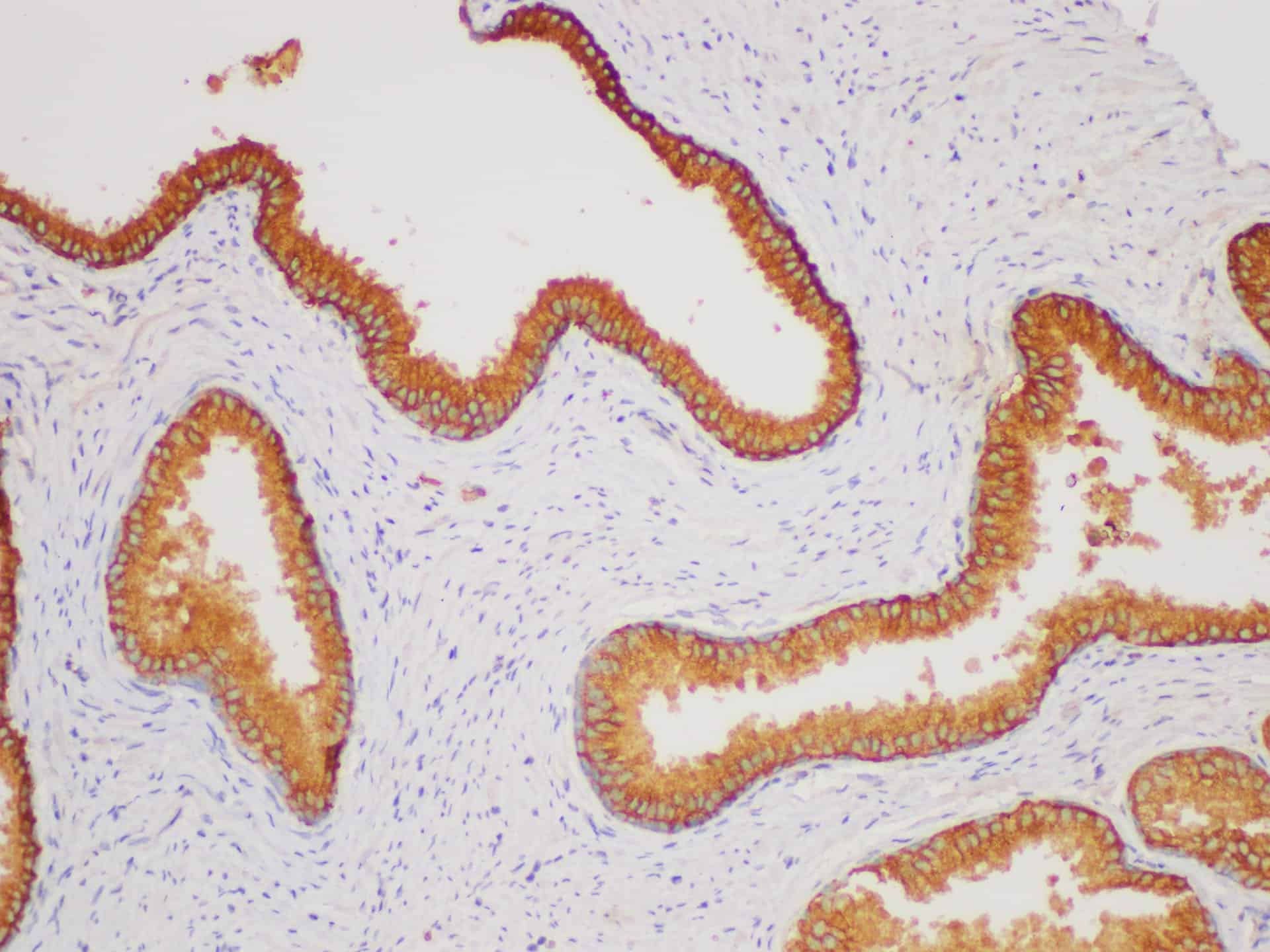 CD38 Polyclonal Antibody Host Rabbit