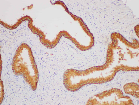 CD38 Polyclonal Antibody Host Rabbit