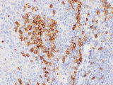 CD38 Polyclonal Antibody Host Rabbit