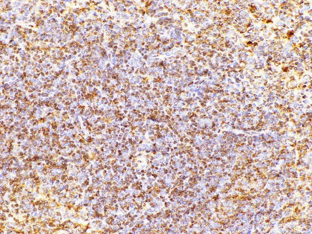 CD38 Polyclonal Antibody Host Rabbit