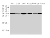 ANXA5 Polyclonal Antibody Host Rabbit