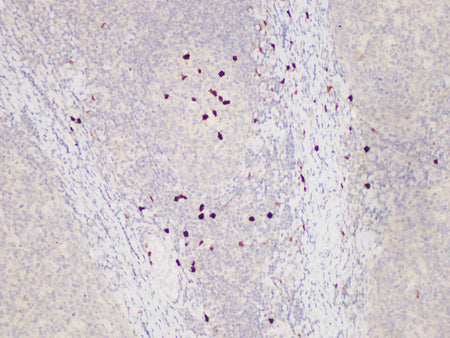 S100A12 Polyclonal Antibody Host Rabbit - Biomarkers - Elabscience Biotechnology - MSE Supplies