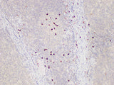 S100A12 Polyclonal Antibody Host Rabbit