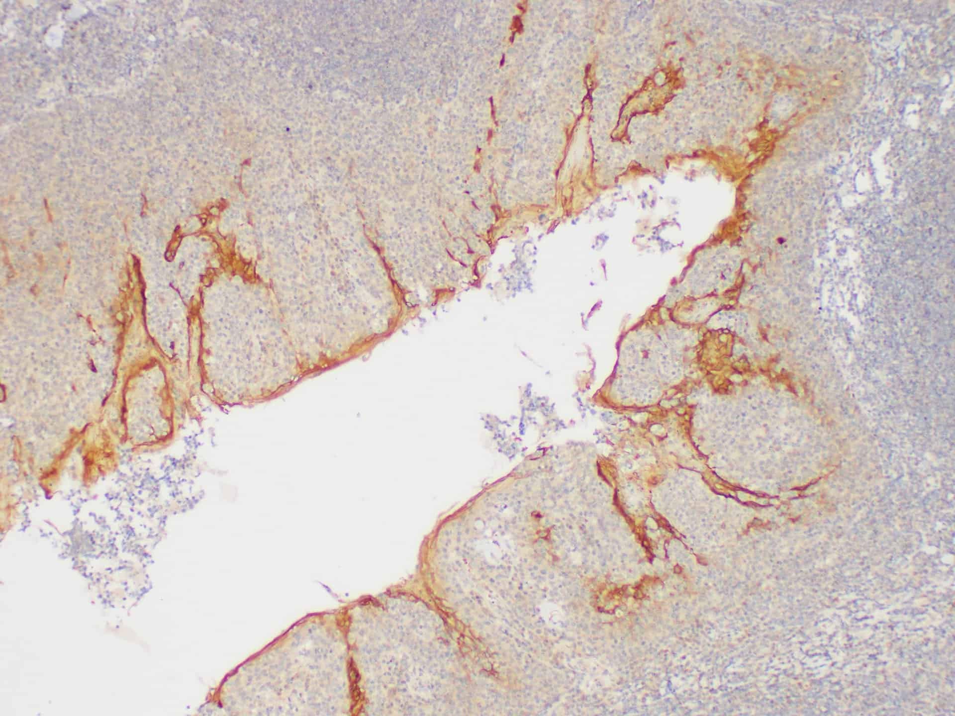 Serpinb2 Polyclonal Antibody Host Rabbit