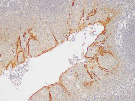 Serpinb2 Polyclonal Antibody Host Rabbit