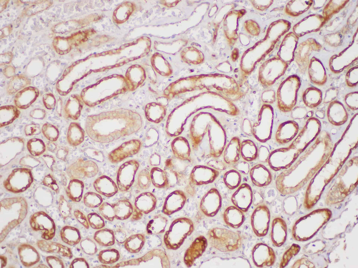 Serpinb2 Polyclonal Antibody Host Rabbit