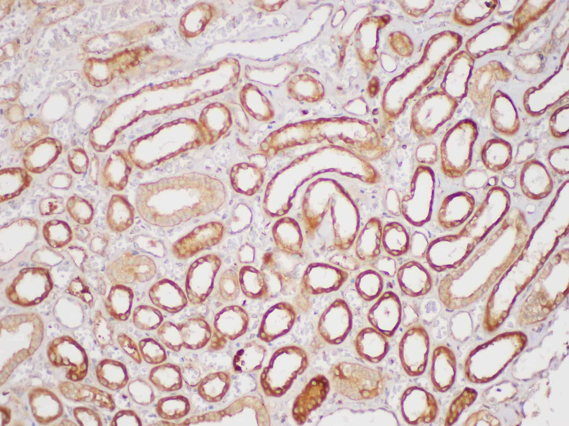 Serpinb2 Polyclonal Antibody Host Rabbit