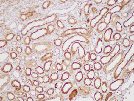 Serpinb2 Polyclonal Antibody Host Rabbit
