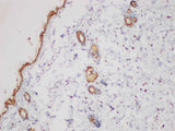Serpinb2 Polyclonal Antibody Host Rabbit