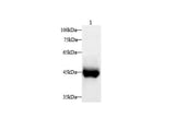 Serpinb2 Polyclonal Antibody Host Rabbit