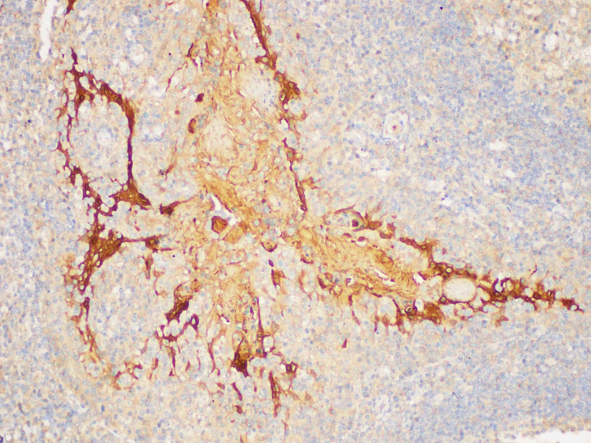 SERPINB2 Polyclonal Antibody Host Rabbit