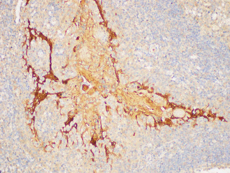 SERPINB2 Polyclonal Antibody Host Rabbit