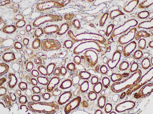 SERPINB2 Polyclonal Antibody Host Rabbit
