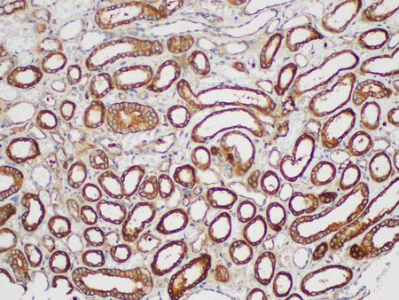 SERPINB2 Polyclonal Antibody Host Rabbit