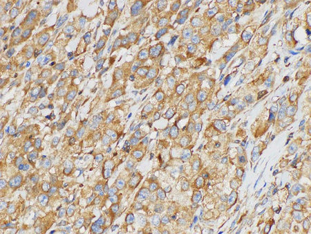 SERPINB2 Polyclonal Antibody Host Rabbit