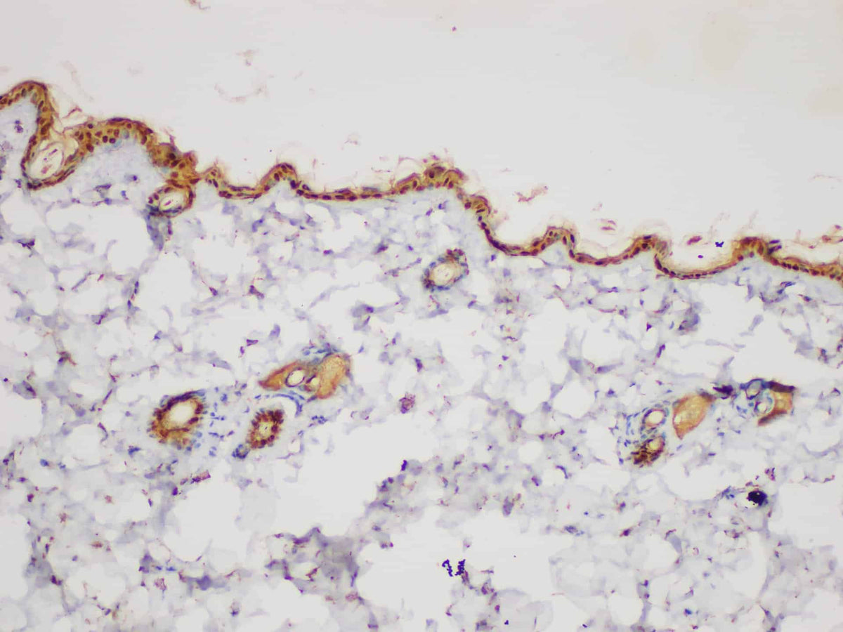 SERPINB2 Polyclonal Antibody Host Rabbit