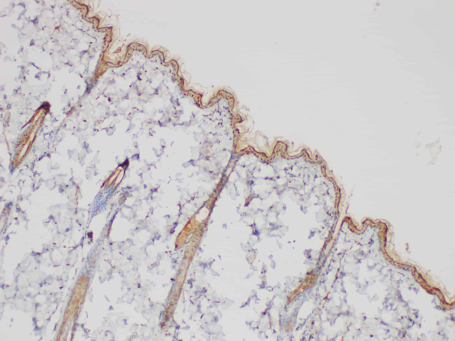 SERPINB2 Polyclonal Antibody Host Rabbit