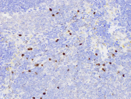 SERPINB2 Polyclonal Antibody Host Rabbit
