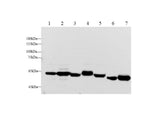 ANG2 Polyclonal Antibody