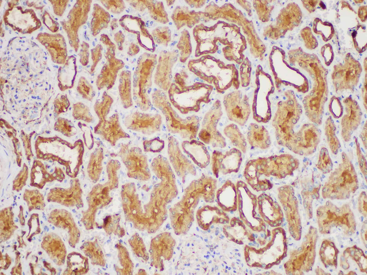 MIF Polyclonal Antibody