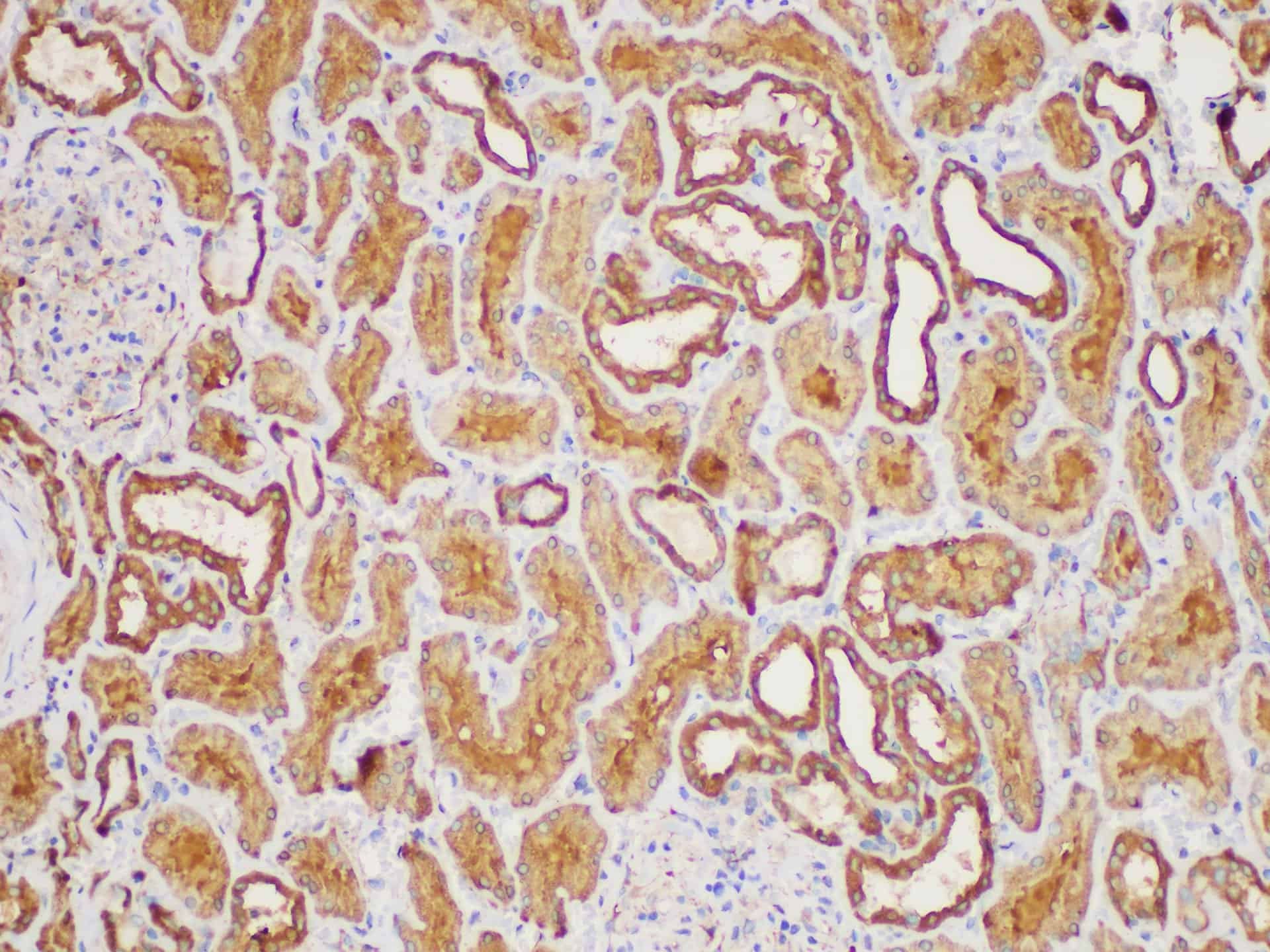 MIF Polyclonal Antibody