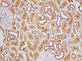 MIF Polyclonal Antibody
