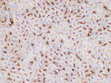 MIF Polyclonal Antibody