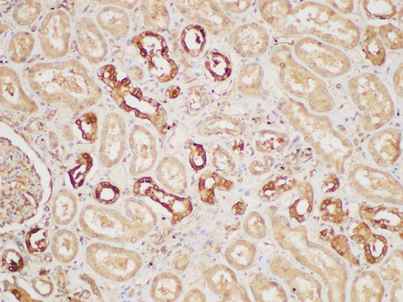PAIP1 Polyclonal Antibody Host Rabbit