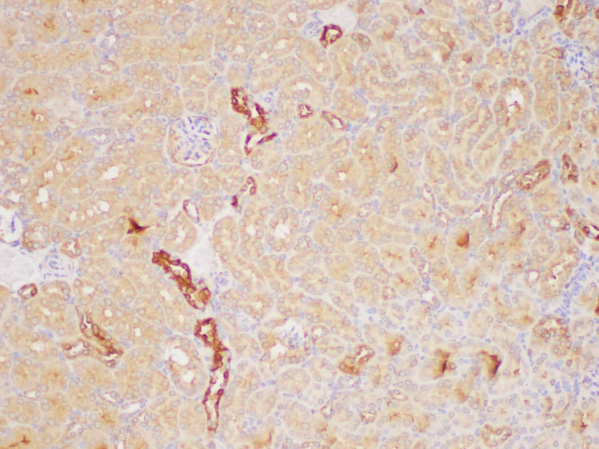 PAIP1 Polyclonal Antibody Host Rabbit