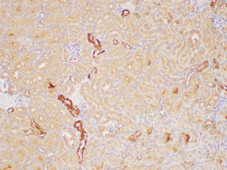 PAIP1 Polyclonal Antibody Host Rabbit