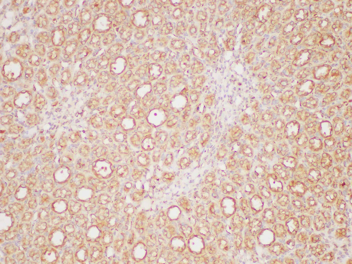 PAIP1 Polyclonal Antibody Host Rabbit