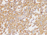 PAIP1 Polyclonal Antibody Host Rabbit