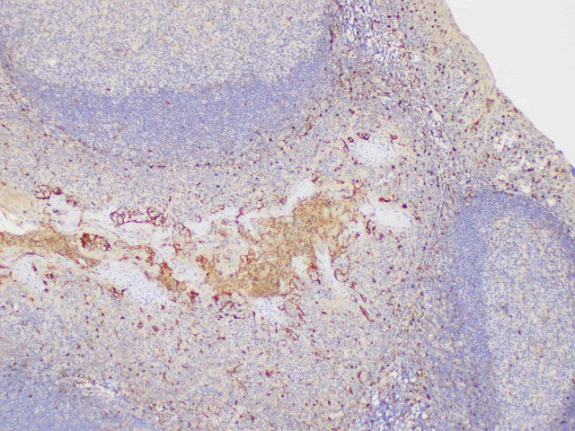 S100A4 Polyclonal Antibody Host Rabbit