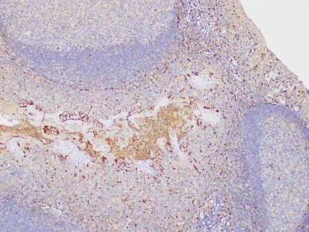 S100A4 Polyclonal Antibody Host Rabbit